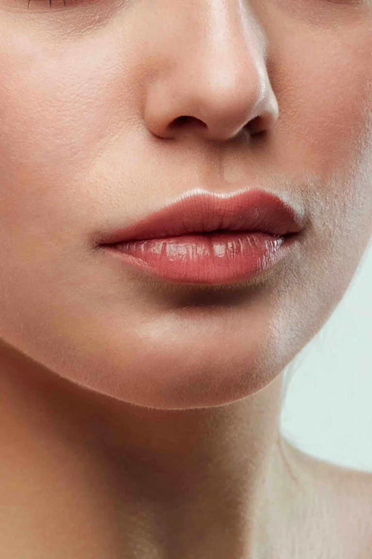 Aumento de Labio