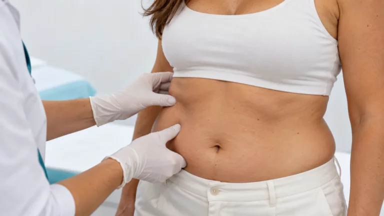 Valoración médica de grasa localizada en abdomen y flanco